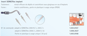 SONICflex embout plastique implant refuel (30 unités)